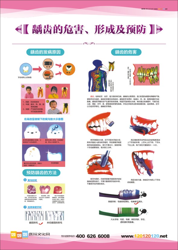 牙科診室圖片 牙科醫(yī)院圖片 口腔科掛圖-齲齒的危害、形成及預(yù)防